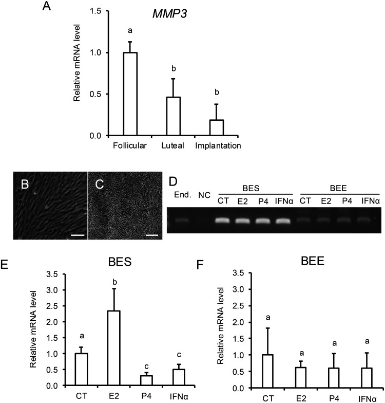 MMP3 mediates E2-induced bovine endometrial cell proliferation by releasing HB-EGF.