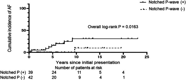 The Utility of Notched P-Wave on the Occurrence of Ventricular Fibrillation in Patients With Brugada Syndrome.