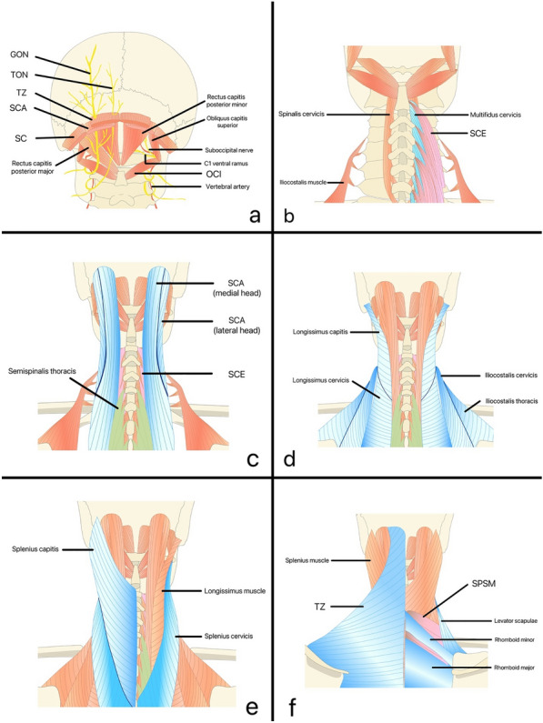 Understanding the Anatomy of Posterior Cervical Interfascial Space: Implications for Regional Blocks and Pain Management. A Narrative Review.