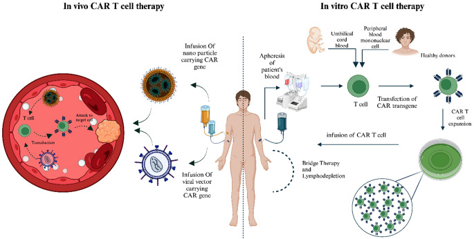 State of the art in CAR-based therapy: In vivo CAR production as a revolution in cell-based cancer treatment.
