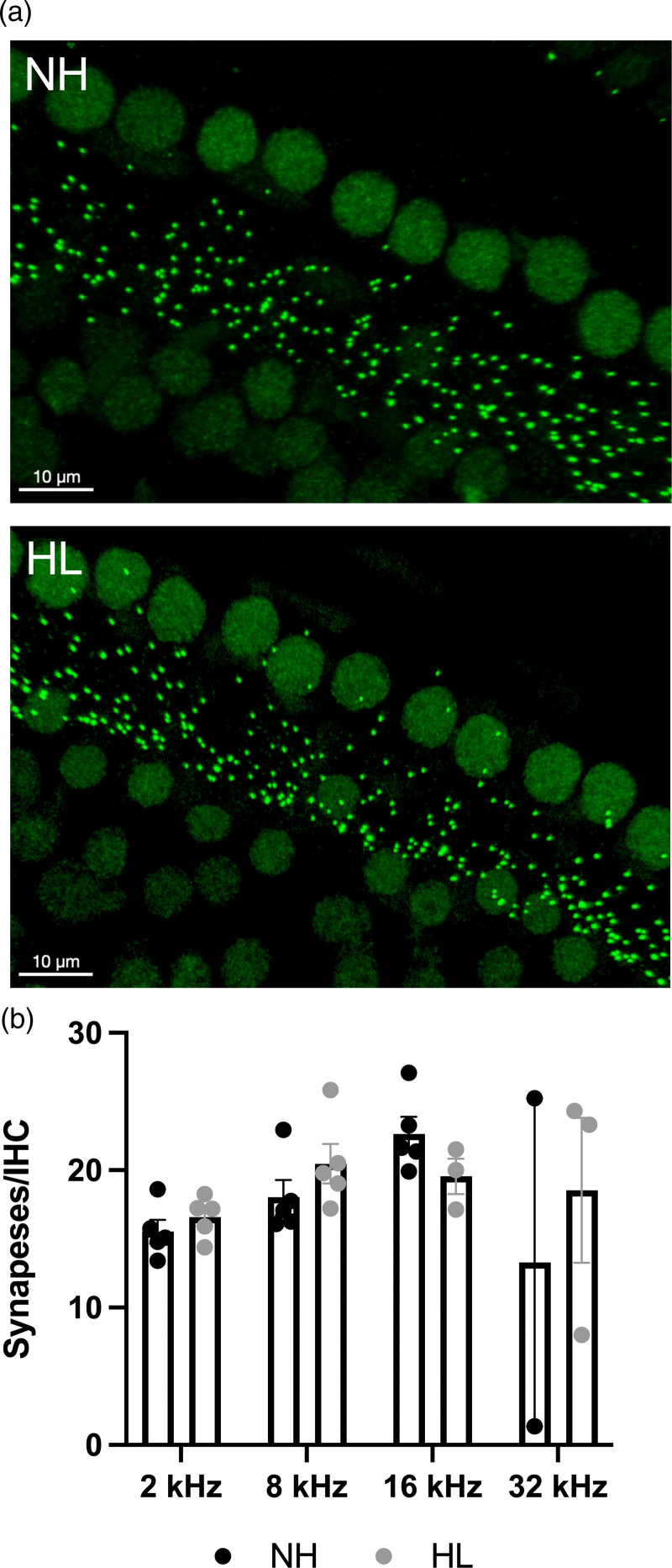 Slight and hidden hearing loss differentially affect short- and long-term memory in young rats.