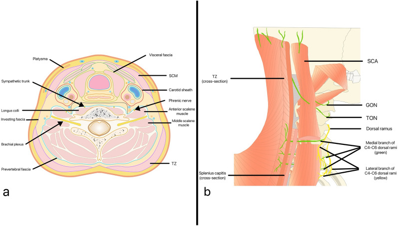 Understanding the Anatomy of Posterior Cervical Interfascial Space: Implications for Regional Blocks and Pain Management. A Narrative Review.