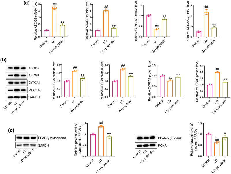 Polydatin prevents cholesterol gallstone formation by regulating cholesterol metabolism via PPAR-γ signaling.