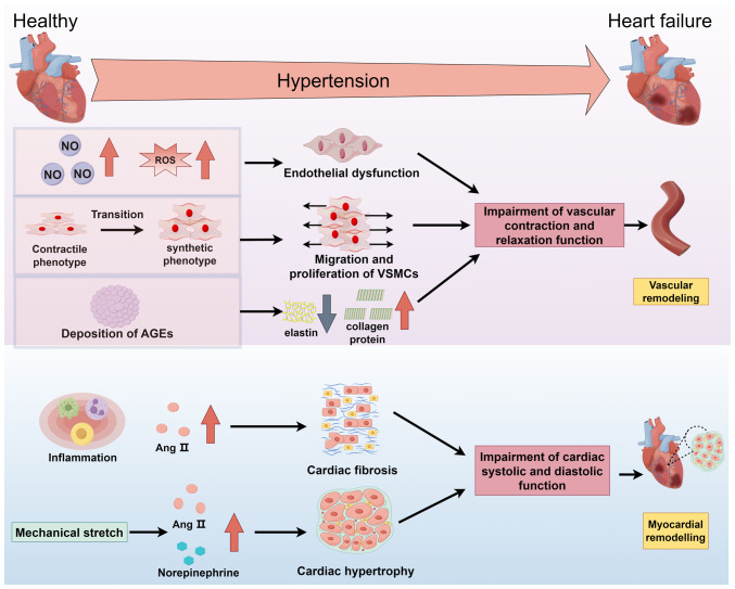 Molecular mechanisms and intervention approaches of heart failure (Review).