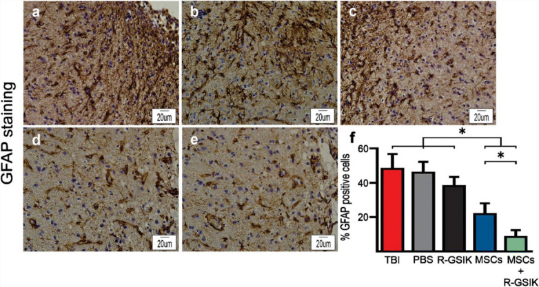 Correction to: Transplantation of R-GSIK scaffold with mesenchymal stem cells improves neuroinflammation in a traumatic brain injury model.