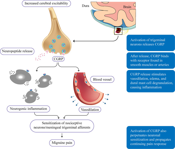 Gepants in Primary Care: A Targeted Approach to Acute and Preventive Treatment of Migraine.