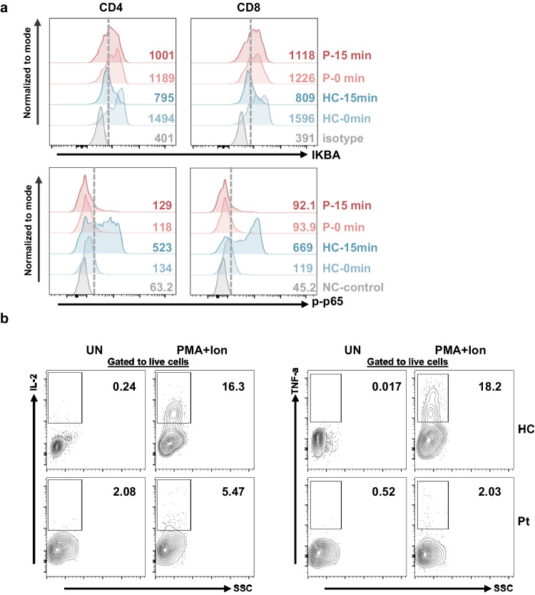 Loss of MALT1 Function in a Patient With Combined Immunodeficiency: a Novel Pathogenic Variant and Immunological Insights.