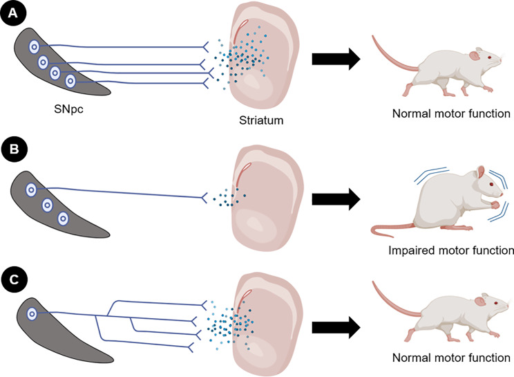Neurodegeneration in Parkinson's disease: are we looking at the right spot?