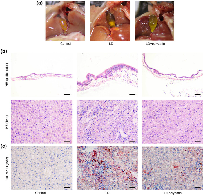 Polydatin prevents cholesterol gallstone formation by regulating cholesterol metabolism via PPAR-γ signaling.