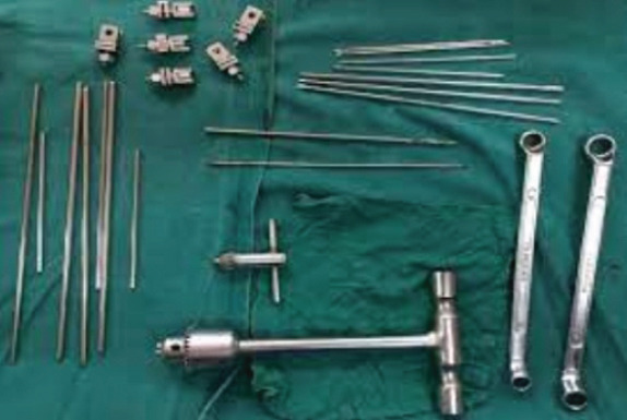 Modified Minimally Invasive Reduction and Osteosynthesis System Technique for Fixation of Distal Radius.