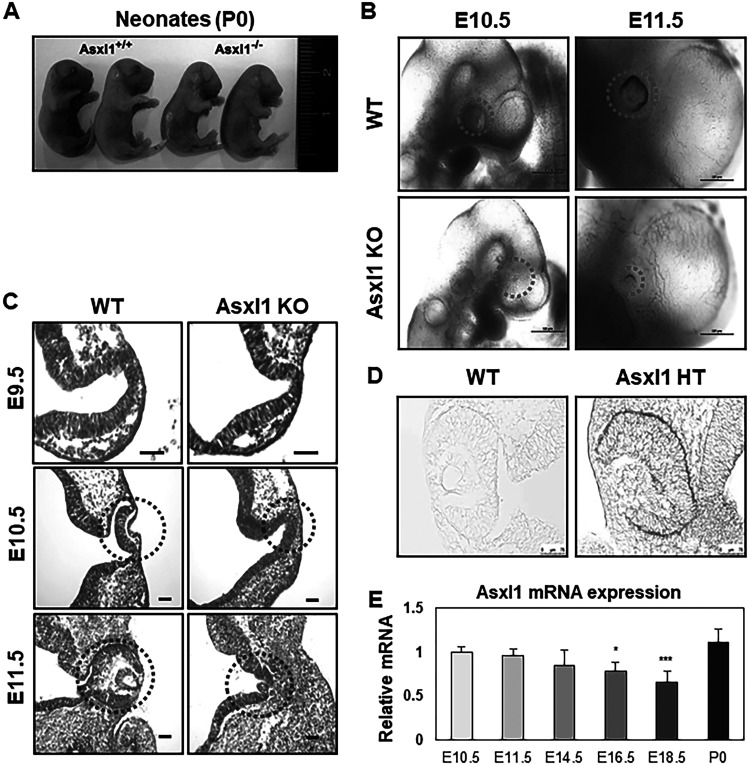 Asxl1 regulates optic cup development through interaction with Lhx2 and epigenetic modulation of Wnt signaling.