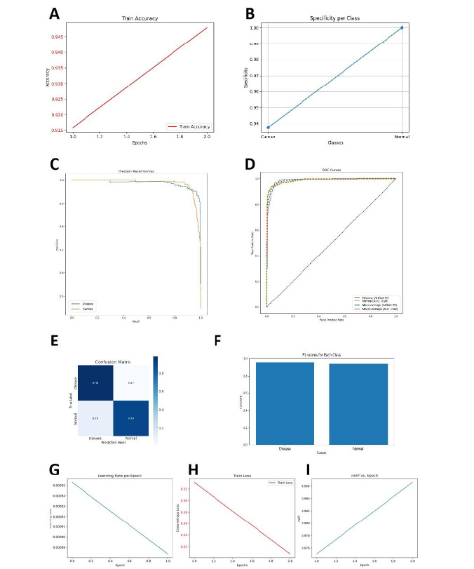Predictive Modeling of Osteonecrosis of the Femoral Head Progression Using MobileNetV3_Large and Long Short-Term Memory Network: Novel Approach.
