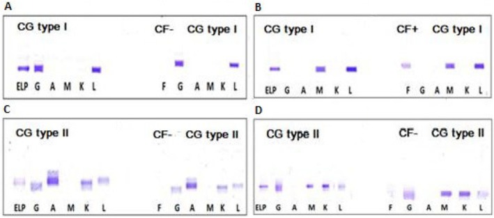 Laboratory Practices for the Detection and Characterization of Cryoglobulins and Cryofibrinogen.