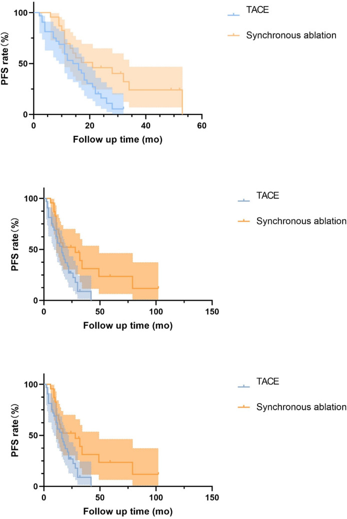 Comparison of TACE alone versus TACE combined with synchronous ablation for neuroendocrine neoplasms with liver metastases.