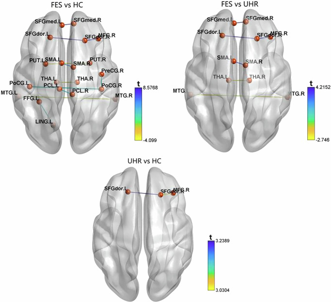 A frame network study of first-episode schizophrenia, ultra-high risk, and healthy populations.