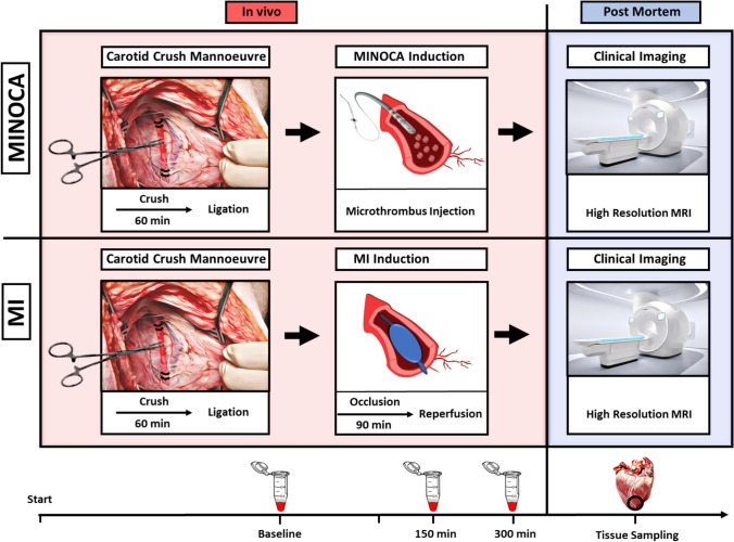 Molecular screening in a translational large animal trial identifies a differential inflammatory response for MINOCA.