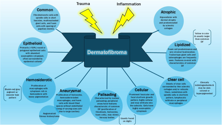 Dermatofibroma: Reappraisal and Updated Review.