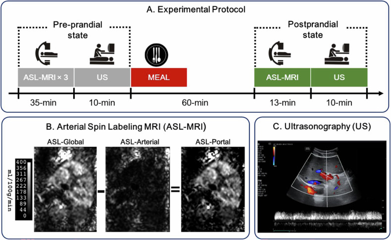Short-term repeatability and postprandial effect assessment of liver perfusion quantification in healthy subjects using arterial spin labeling MRI.