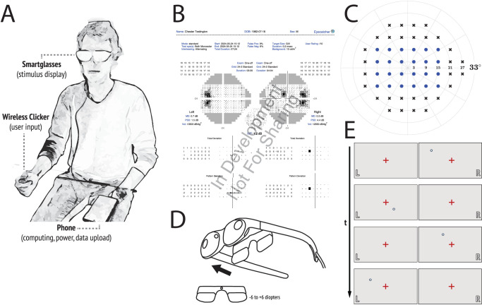 Eyecatcher 3.0 - Validating the Use of "Smart Glasses" as a Low-Cost, Portable Method of Assessing Visual Fields.