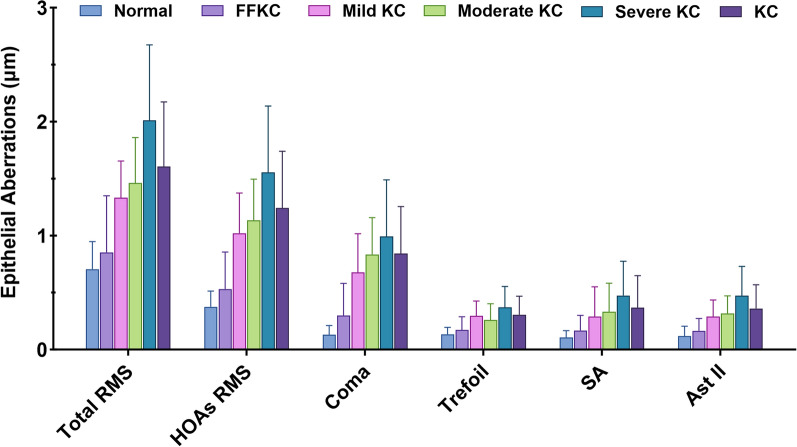 Corneal epithelial aberrations: a novel diagnostic tool for keratoconus and forme fruste keratoconus.
