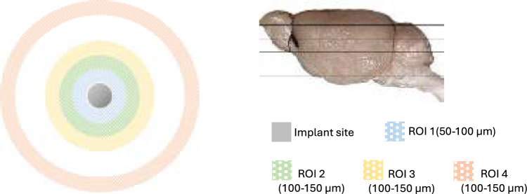 3D-printed optogenetic neural probe integrated with microfluidic tube for opsin/drug delivery.