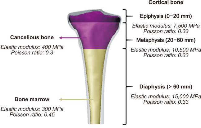 Optimal Plate Position for Biomechanical Stability in Medial Opening-Wedge High Tibial Osteotomy: A Finite Element Analysis.