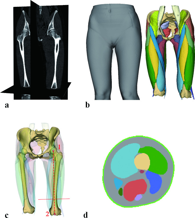 Evaluating upper leg muscle volume : the reliability of thigh circumference measurement 10 cm above the patella.
