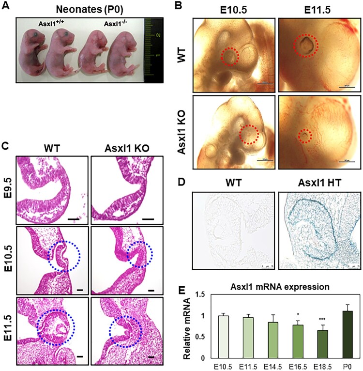Asxl1 regulates optic cup development through interaction with Lhx2 and epigenetic modulation of Wnt signaling.
