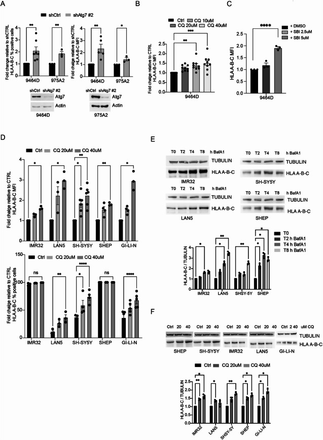 Correction: Inhibition of autophagy enhances the antitumor efficacy of T/CAR T cell against neuroblastoma.