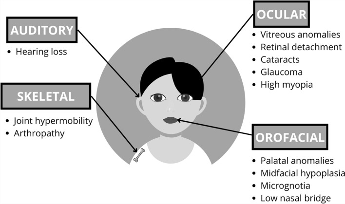 Characteristics of Hearing Loss in Patients with <i>COL2A1</i> Gene Variants (Sticker Syndrome Type 1).