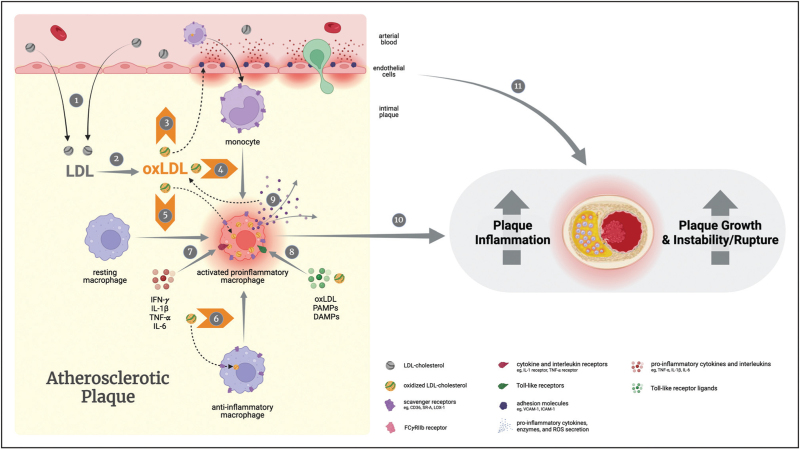 Orticumab: the potential to harness oxidized LDL to reduce coronary inflammation with plaque-targeted therapy.