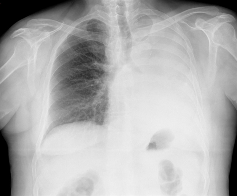 Gamified Learning in a Virtual World for Undergraduate Emergency Radiology Education: Quasi-Experimental Study.