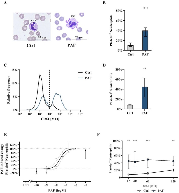 Platelet-Activating Factor Promotes Neutrophil Activation and Platelet-Neutrophil Complex Formation.