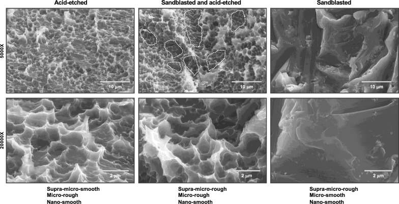 The 3D theory of osseointegration: material, topography, and time as interdependent determinants of bone-implant integration.