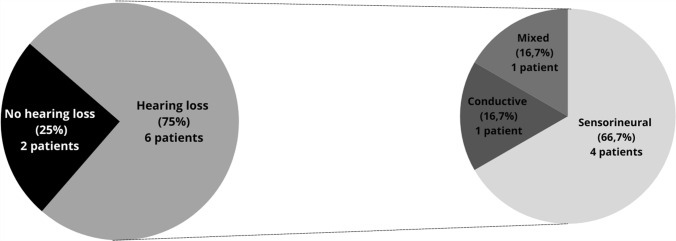 Characteristics of Hearing Loss in Patients with <i>COL2A1</i> Gene Variants (Sticker Syndrome Type 1).