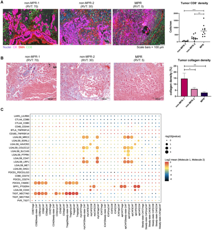 Cancer-associated fibroblasts and metabolic reprogramming predict pathologic response to neoadjuvant PD-1 blockade in resected non-small cell lung cancer.