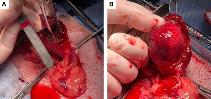 Spontaneous urinary bladder rupture in a dog with lymphoplasmacytic cystitis.