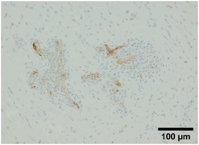 Feline systemic reactive angioendotheliomatosis with hypercalcaemia.