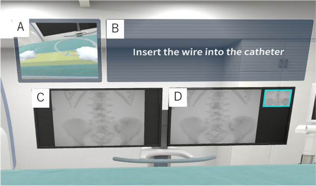Effectiveness of a virtual reality-based interventional radiology simulator for medical student education.