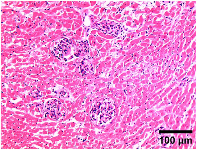 Feline systemic reactive angioendotheliomatosis with hypercalcaemia.