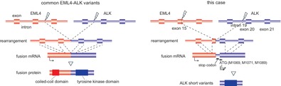 Lung Adenocarcinoma Expressing an EML4-ALK Fusion Transcript With Premature Stop Codons and Response to Alectinib: A Case Report.