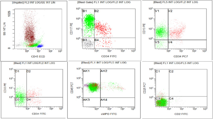 Myelomastocytic transformation in chronic myeloid leukemia blast phase: A case report.