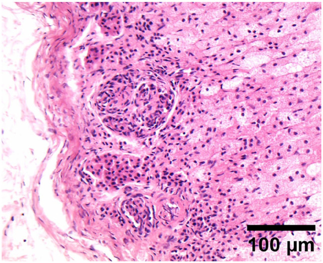 Feline systemic reactive angioendotheliomatosis with hypercalcaemia.