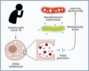 Granulysin Antimicrobial Activity Promotes Dormancy in Mycobacterium tuberculosis.