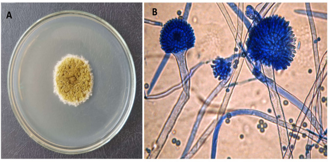 Biochemical and biological evaluation of L-glutaminase from Aspergillus tamarii AUMC 10198 via solid-state fermentation.