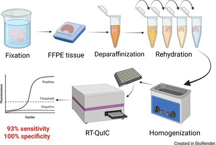 Detection of Human Prion Seeding Activity in Formalin-Fixed Paraffin-Embedded Archival Tissues.