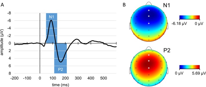 Conflicting Motor Plans and Sensory Attenuation: Evidence From Event-Related Potentials for Sounds Generated by Pro- and Antisaccades.