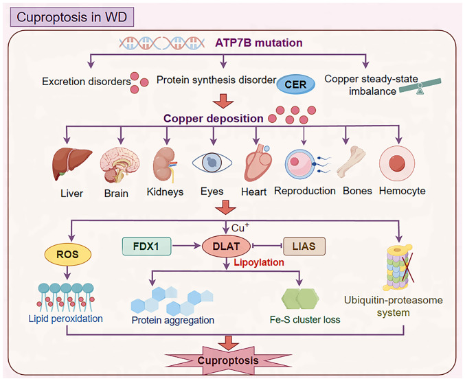 Role and mechanisms of cuproptosis in the pathogenesis of Wilson's disease (Review).