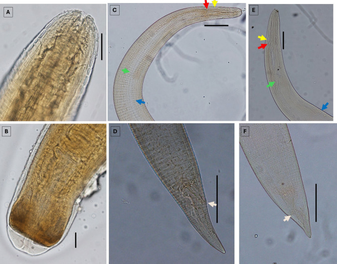 Detection of zoonotic nematodes in brown trout, Salmo trutta, an introduced popular edible freshwater fish in Australia.