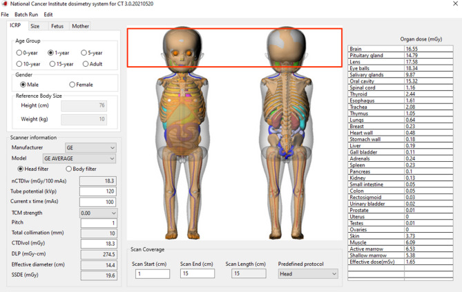 Determination of redundant scan coverages along the Z-axis and dose implications for common paediatric computed tomography imaging examinations in a limited resource setting.
